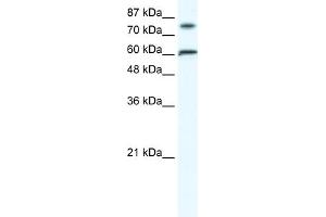 WB Suggested Anti-FLJ23436 Antibody Titration:  1. (ZNF768 Antikörper  (N-Term))