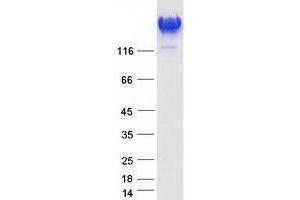 Western Blotting (WB) image for Spectrin alpha Chain, Brain (SPTAN1) (Transcript Variant 1) protein (Myc-DYKDDDDK Tag) (ABIN2732546)