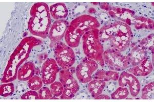 Human Kidney: Formalin-Fixed Paraffin-Embedded (FFPE) (Glycerol Kinase Antikörper  (AA 461-510))