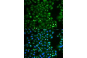 Immunofluorescence analysis of A549 cell using ANXA11 antibody.