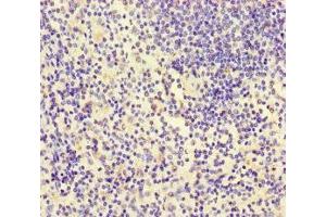 Immunohistochemistry of paraffin-embedded human spleen tissue using ABIN7156438 at dilution of 1:100 (ITGA4 Antikörper  (AA 376-558))
