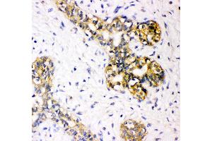 Immunohistochemistry (IHC) image for anti-Tuberous Sclerosis 2 (TSC2) (AA 1611-1807) antibody (ABIN3043498)