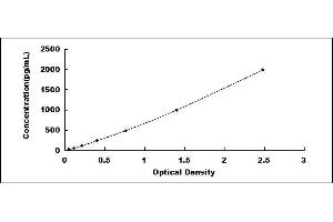 ELISA image for Cardiac Troponin I (TNNI3) ELISA Kit (ABIN415407)