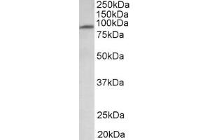 Western Blotting (WB) image for anti-Major Facilitator Superfamily Domain Containing 6 (MFSD6) (AA 164-175), (Extracellular Domain) antibody (ABIN1103026) (MFSD6 Antikörper  (Extracellular Domain))