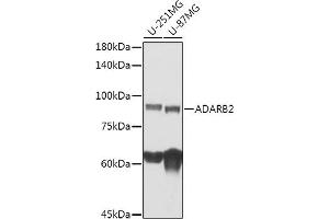Western blot analysis of extracts of various cell lines, using  antibody (ABIN7265460) at 1:1000 dilution.
