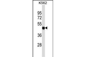 Western Blotting (WB) image for anti-Purinergic Receptor P2X, Ligand-Gated Ion Channel, 5 (P2RX5) (AA 325-353), (C-Term) antibody (ABIN657980)