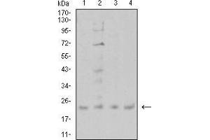 Western Blotting (WB) image for anti-Cold Inducible RNA Binding Protein (CIRBP) (AA 1-90) antibody (ABIN5542478)