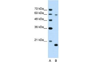 WB Suggested Anti-SLC38A4 Antibody Titration:  2. (SLC38A4 Antikörper  (Middle Region))