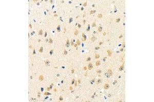 Immunohistochemistry of paraffin embedded mouse brain using rasgrf1 (ABIN7073422) at dilution of 1:4000 (400x lens) (Cdc25 Antikörper)