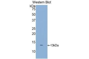 Detection of Recombinant DKK2, Human using Polyclonal Antibody to Dickkopf Related Protein 2 (DKK2) (DKK2 Antikörper  (AA 159-258))