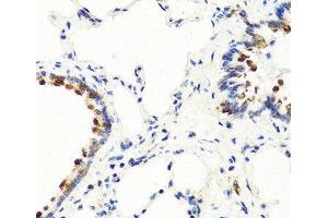 Immunohistochemistry of paraffin-embedded Rat lung using NTF3 Polyclonal Antibody at dilution of 1:100 (40x lens). (Neurotrophin 3 Antikörper)