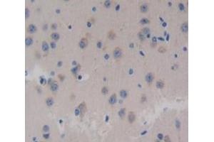 Used in DAB staining on fromalin fixed paraffin- embedded Kidney tissue (Neurocan Antikörper  (AA 960-1225))