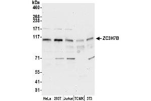 Western Blotting (WB) image for anti-Zinc Finger CCCH-Type Containing 7B (ZC3H7B) (AA 250-300) antibody (ABIN7449927)