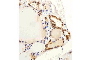 anti-Chromosome 13 Open Reading Frame 30 (C13orf30) (AA 106-139), (C-Term) antibody