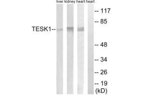 TESK1 抗体