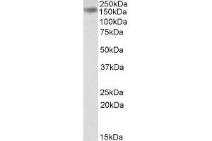 Western Blotting (WB) image for anti-Drosha, Ribonuclease Type III (DROSHA) antibody (ABIN5927621) (DROSHA Antikörper)