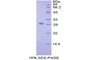 SDS-PAGE (SDS) image for Coagulation Factor IX (F9) (AA 232-455) protein (His tag) (ABIN1877485) (Coagulation Factor IX Protein (F9) (AA 232-455) (His tag))