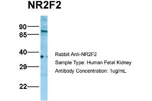 Host:  Rabbit  Target Name:  NR2F2  Sample Type:  Human Fetal Kidney  Antibody Dilution:  1. (NR2F2 Antikörper  (N-Term))