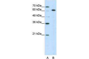 Western Blotting (WB) image for anti-Small Nuclear Ribonucleoprotein 70kDa (U1) (SNRNP70) antibody (ABIN2462077) (SNRNP70 Antikörper)