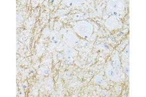 Immunohistochemistry of paraffin-embedded Mouse spinal cord using CNP Polyclonal Antibody at dilution of 1:100 (40x lens). (Cnpase Antikörper)