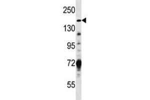 Hamartin antibody western blot analysis in MDA-MB231 lysate (TSC1 Antikörper  (AA 401-430))