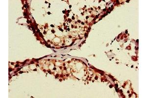 Immunohistochemistry of paraffin-embedded human testis tissue using ABIN7174147 at dilution of 1:100 (ZRSR2 Antikörper  (AA 191-372))