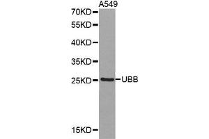 Western blot analysis of extracts of A549 cell lines, using UBB antibody. (Ubiquitin B Antikörper  (AA 1-76))