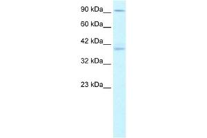 KIFC2 antibody used at 1.