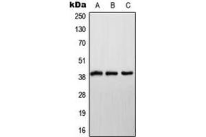 Western blot analysis of NDUFA9 expression in HeLa (A), SP2/0 (B), H9C2 (C) whole cell lysates.