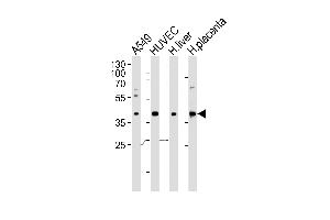 Western blot analysis of lysates from A549, HUVEC cell line and human liver, placenta tissue lysate(from left to right), using OLR1 Antibody (Center) (ABIN652795 and ABIN2842521).