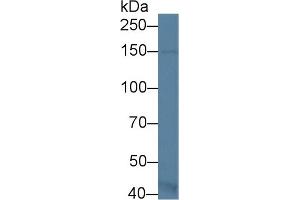 Western Blot; Sample: Mouse Kidney lysate; Primary Ab: 1µg/ml Rabbit Anti-Mouse ASK1 Antibody Second Ab: 0. (ASK1 Antikörper  (AA 693-933))