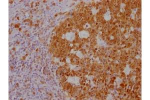 IHC image of ABIN7180562 diluted at 1:100 and staining in paraffin-embedded human tonsil tissue performed on a Leica BondTM system. (POU2AF1 Antikörper)