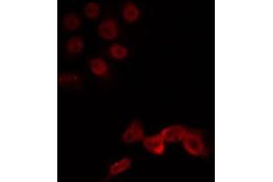 ABIN6266719 staining Hela by IF/ICC. (LMX1B Antikörper  (Internal Region))