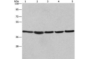 Western Blot analysis of A549, NIH/3T3 and 293T cell,Human hepatocellular carcinoma tissue and hela cell using RPSA Polyclonal Antibody at dilution of 1:433. (RPSA/Laminin Receptor Antikörper)