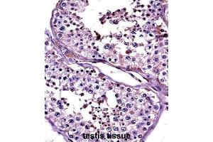 Immunohistochemistry (IHC) image for anti-Cancer/testis Antigen 2 (CTAG2) antibody (ABIN2997526) (CTAG2 Antikörper)