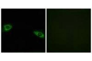 Immunofluorescence analysis of HuvEc cells, using RPS4Y1 antibody. (RPS4Y1 Antikörper  (C-Term))