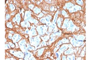 Immunohistochemistry (IHC) image for anti-Periostin (POSTN) (AA 193-326) antibody (ABIN7504149)