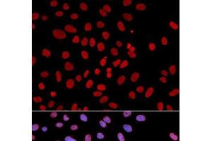 Immunofluorescence analysis of U2OS cells using PTPN6 Polyclonal Antibody (SHP1 Antikörper)