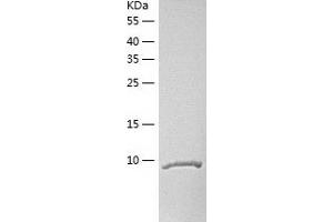 Western Blotting (WB) image for Chemokine (C-C Motif) Ligand 27 (CCL27) (AA 26-120) protein (His tag) (ABIN7122294) (CCL27 Protein (AA 26-120) (His tag))