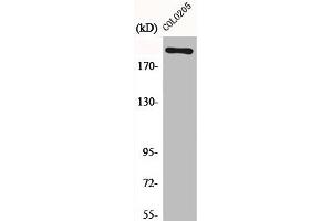 Western Blot analysis of COLO205 cells using EGFL4 Polyclonal Antibody (MEGF8 Antikörper  (Internal Region))