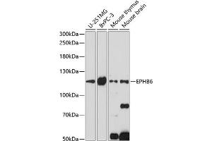 Western blot analysis of extracts of various cell lines, using EPHB6 antibody (ABIN7266973) at 1:1000 dilution. (EPH Receptor B6 Antikörper  (AA 615-729))