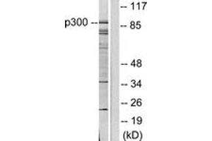 Western blot analysis of extracts from COLO205 cells, using p300/CBP Antibody. (KAT2B Antikörper  (AA 783-832))