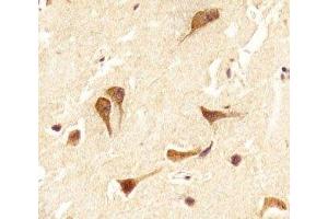 IHC analysis of FFPE human brain section using OTX2 antibody; Ab was diluted at 1:25. (OTX2 Antikörper  (C-Term))