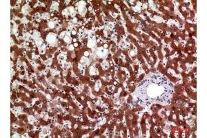 Immunohistochemical analysis of paraffin-embedded human-liver, antibody was diluted at 1:100. (HSD11B1 Antikörper  (N-Term))