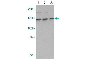 Western blot analysis of lane 1: A549 cell lysate, lane 2: H460 cell lysate and lane 3: H1703 cell lysate using IARS polyclonal antibody . (IARS Antikörper)