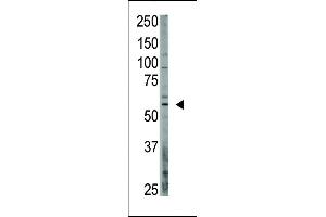 The anti-OASIS C-term Antibody (ABIN390167 and ABIN2840663) is used in Western blot to detect OASIS in  lysate. (CREB3L1 Antikörper  (C-Term))