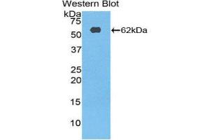 Western Blotting (WB) image for anti-Ribosomal Protein S6 Kinase, 70kDa, Polypeptide 2 (RPS6KB2) (AA 194-453) antibody (ABIN3210026) (RPS6KB2 Antikörper  (AA 194-453))
