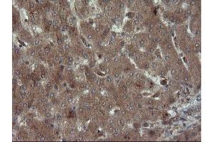 Image no. 1 for anti-Carboxypeptidase A2 (Pancreatic) (CPA2) antibody (ABIN1497598)