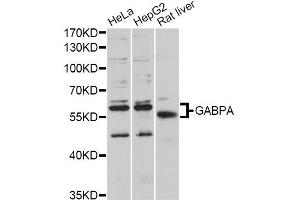 Western blot analysis of extracts of various cell lines, using GABPA antibody (ABIN5997766) at 1/1000 dilution. (GABPA Antikörper)