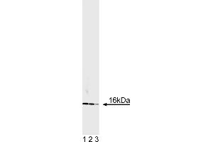 Western Blotting (WB) image for anti-Superoxide Dismutase 1, Soluble (SOD1) antibody (ABIN967513)